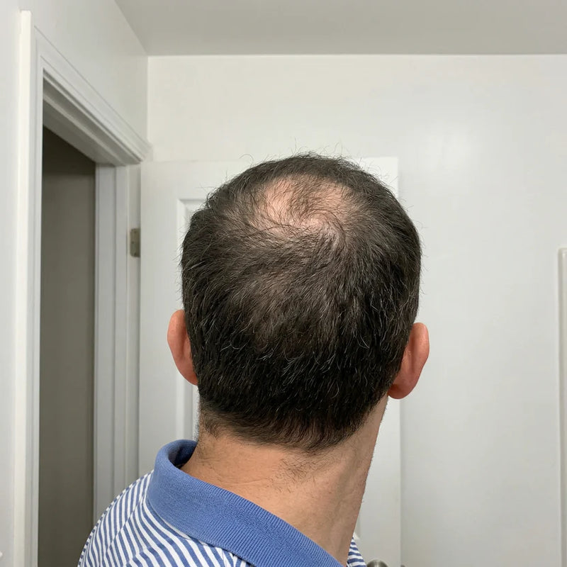 Before — Entradas