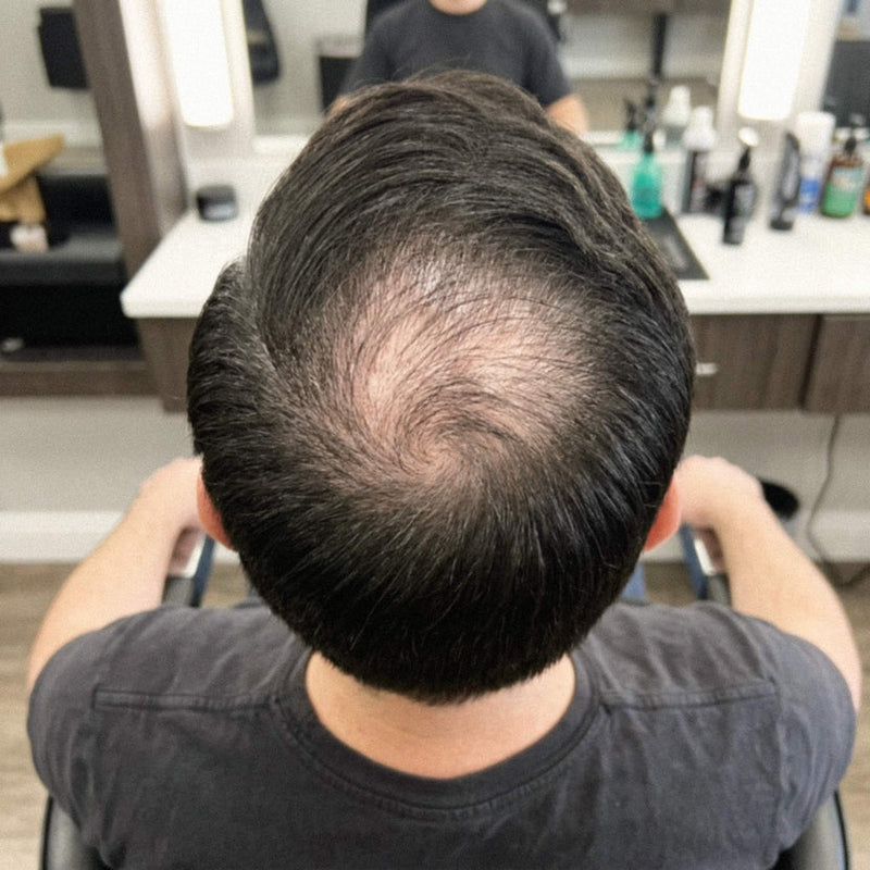 Before — Corona